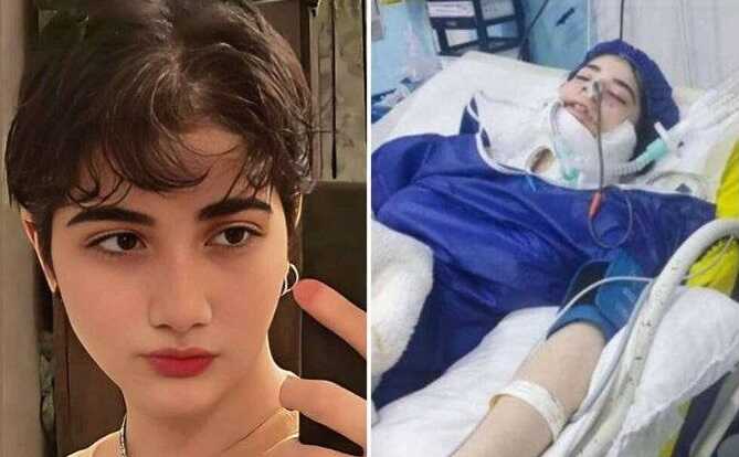 Умерла иранская девочка-подросток, на которую, вероятно, напала полиция из-за того, что она не носила хиджаб