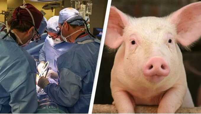 Впервые в мире живому человеку пересадили почку свиньи